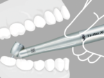 NSK Ti-Max X 450 – Image 5