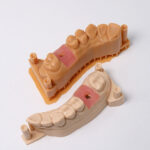Résine Gingiva Mask (fausse gencive) – Image 2