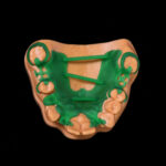 Résine Dental Casting – Image 2