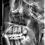 sinus01