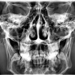 sinus02
